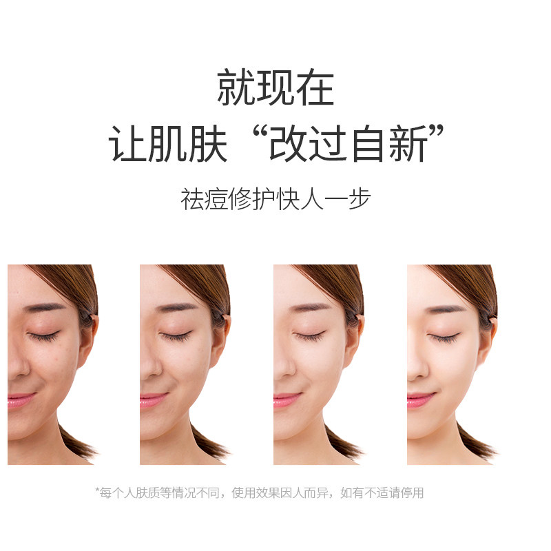 辛有志多肽修护组合淡化正品冻干粉 辛有志专属店液态精华