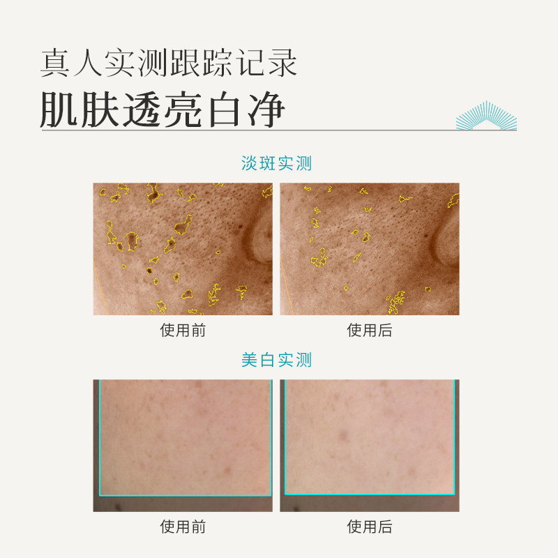 【顺丰包邮】枫缇亮肤美白淡斑祛斑胶囊精华油熬夜提亮次抛敏感 - 图2