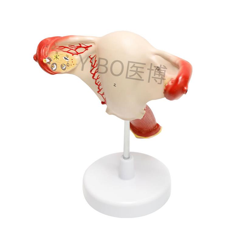 医博BIX-A3422正常子宫模型t女性子宫模型医用教具女性内外生殖器 - 图3