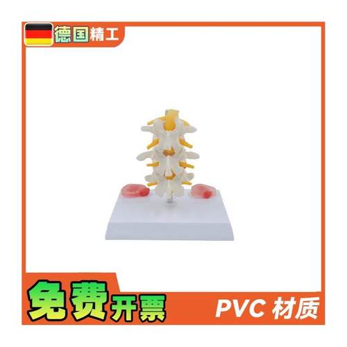 德国】PNT0131三节腰椎带病变椎间盘病变椎间盘骨骼X模型骨科疼痛 - 图3