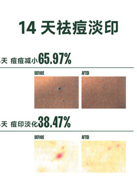 芙芙清透焕肤身体喷雾