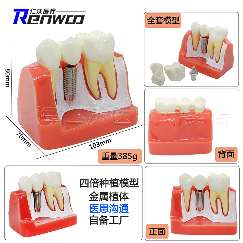 牙齿模型牙模型牙科教学模型种植牙备牙正畸病理口腔模型-图3