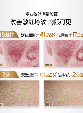 欧诗漫胶原小金管胶原水乳套装