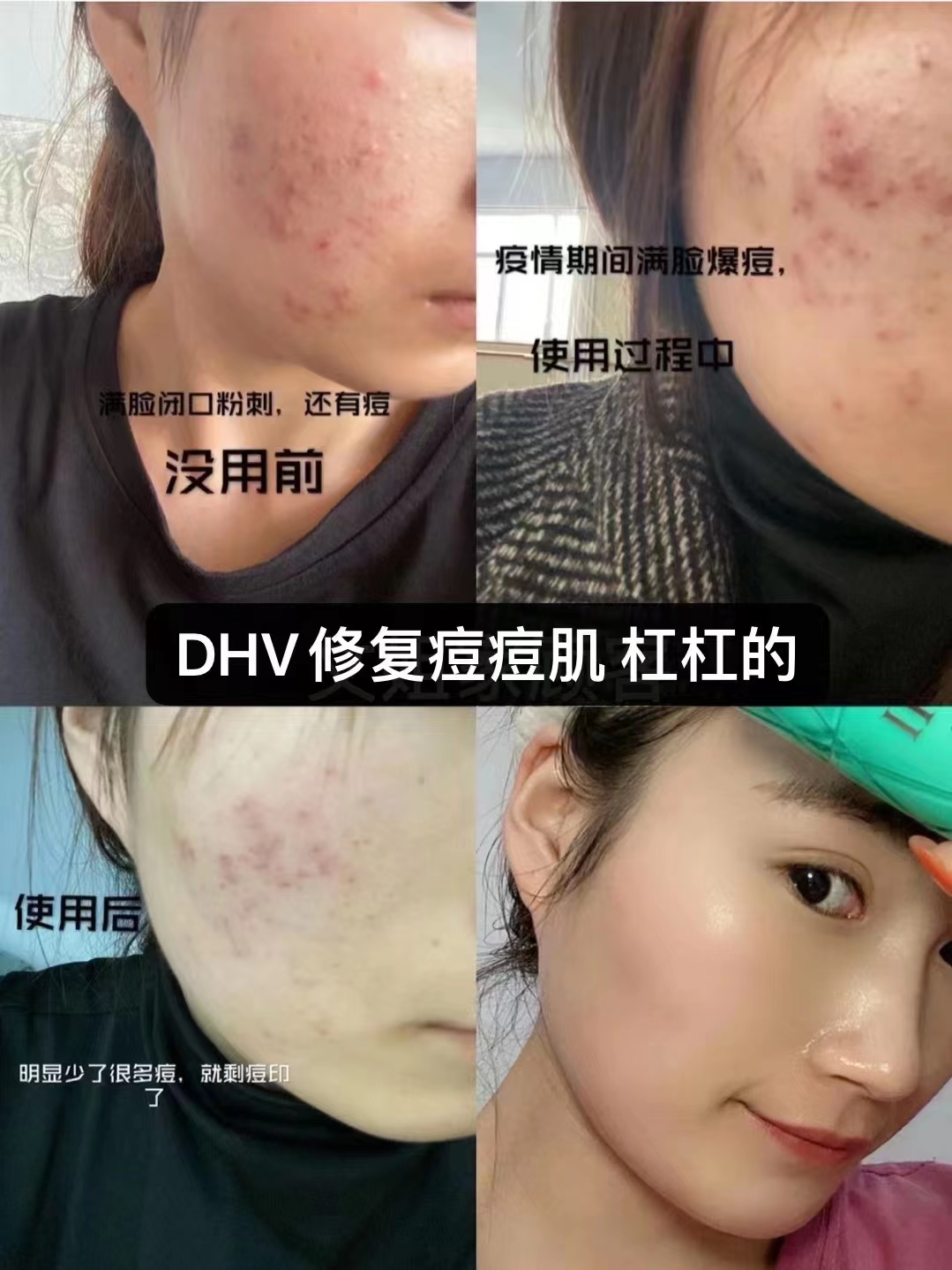 DHV-II官网护肤品套装水乳爽肤水丝滑乳液官方旗舰店奇迹水120ml - 图0