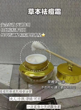 俏贝颜祛痘膏去豆豆正品纯中药去痘痘闭口粉刺草本祛痘霜