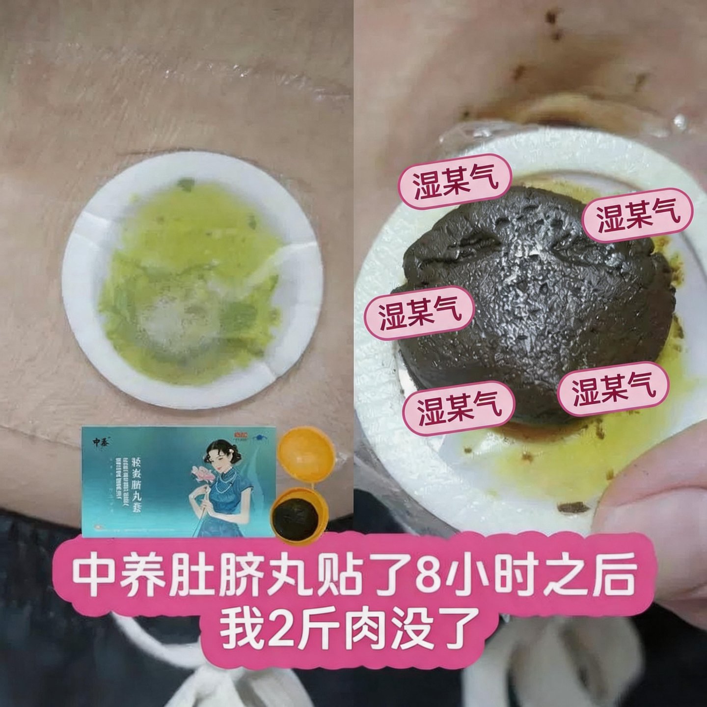 中养轻姿脐丸套新陈代谢塑形美体院线同款正品肚脐丸套盒