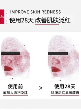 喷雾敏感舒缓屏障清爽补水爽肤水冷敷液体敷料保湿修护不油腻肌肤