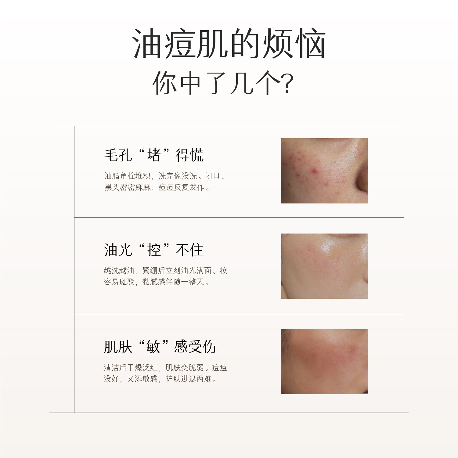 半亩花田三酸洗面奶控油祛痘氨基酸洁面乳深层清洁收缩毛孔男士女