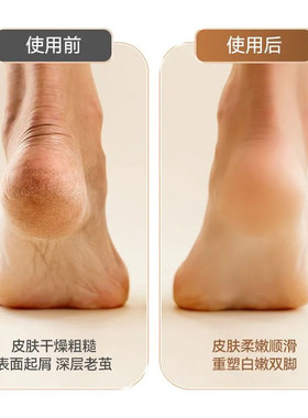 电动磨脚器磨脚器去死皮老茧