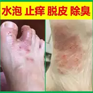 治烂脚推荐品牌 新人首单立减十元 21年6月 淘宝海外