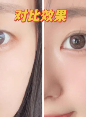 尔木萄信手拈来双眼皮贴