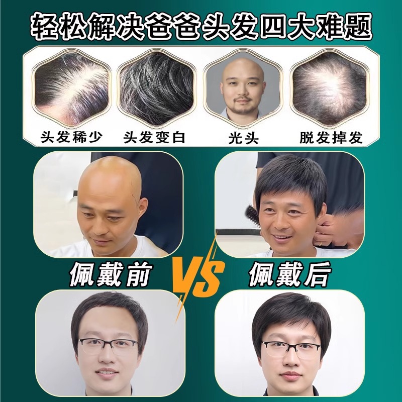 男士假发真人发丝全头套中老年男式短发轻松遮白发盖光头薄款 - 图0