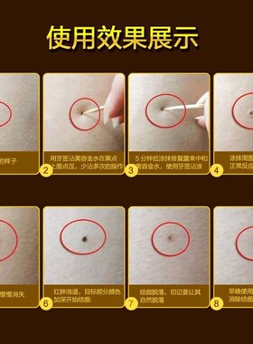 美容金水点痣点斑水凸痣黑痣平痣肉痣雀斑正品
