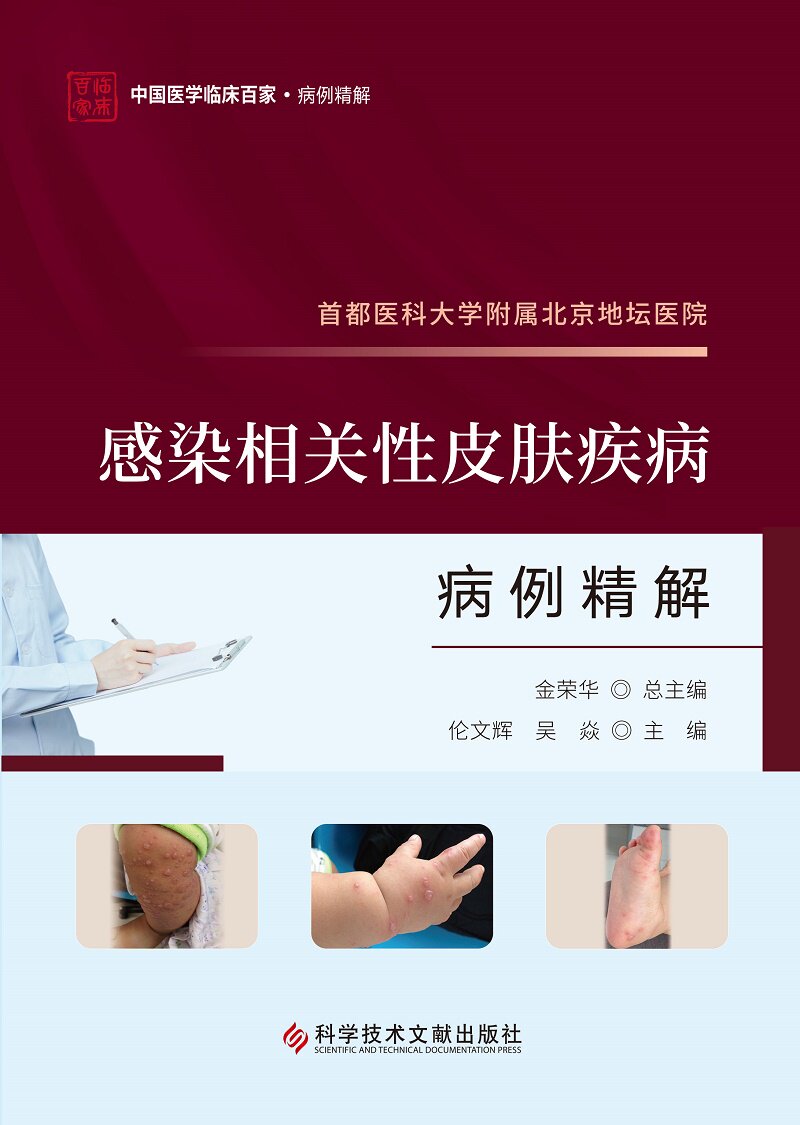 都医科大学附属北京地坛医院感染相关性皮肤疾病病例精解 伦文辉 吴炎主编 中国医学临床百家病例精解 科学技术文献出版社