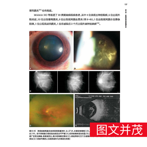 眼内液检测的临床应用 眼科学 医学书籍 2020年7月参考书籍 眼内液检测技术的临床应用 陶勇编著 9787117301367 人民卫生出版社 - 图1