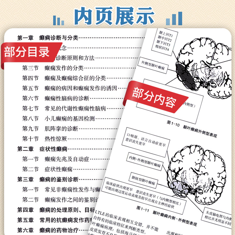 癫痫规范化诊断治疗和管理 神经病和精神病学 癫痫诊断与分类 癫痫的病因和癫痫发作的诱因 癫痫的药物治疗 癫痫手术 科学出版社