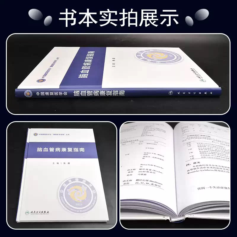 脑血管病康复指南 张通 脑血管病的运动功能障碍康复 感觉障碍康复 规范脑血管病康复的治疗行为 人民卫生出版社 9787117326025