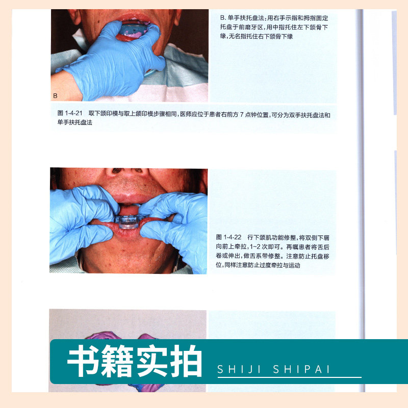 可摘局部义齿设计与应用技术图解 口腔科学 原创手绘示意图临床照片设计与制作过程思考操作视频 少海主编 人民卫生出版社