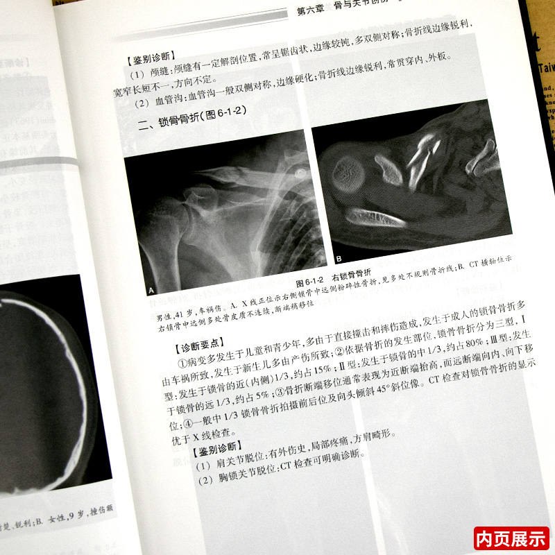 正版 医学影像学读片诊断图谱骨肌分册 丁建平肌骨超声入门技术骨科影像学超声影像医学书籍放射解剖诊断图谱入门影像技术 - 图2