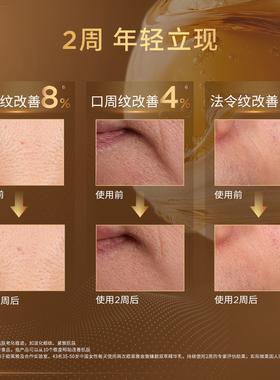 【重磅新品】欧莱雅逆龄双管精华紧致抗老烟酰胺提亮抗氧修护屏障