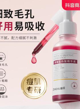 正品果酸换肤刷酸鸡皮肤手部背部身体男士高浓度毛周角化全身净肤