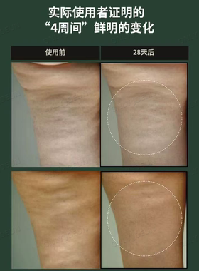 清潭洞院线▲Suelo刮痧美体霜