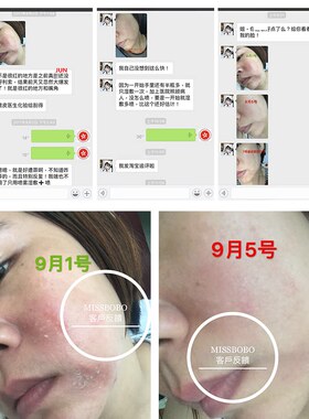 美帕喷雾维生素b5修复补水保湿修护敏感肌肤舒缓爽肤水