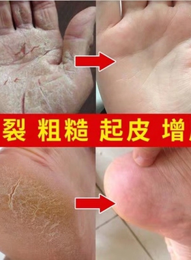 江南一手秘制配方特效抗护手霜