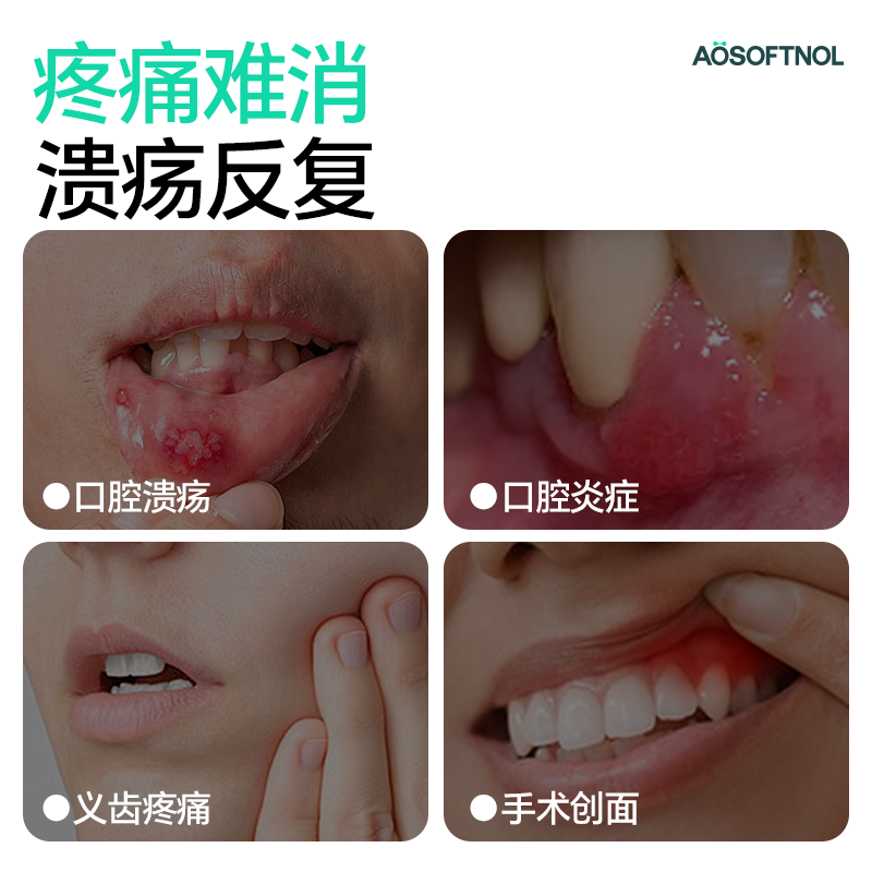 奥舒诺医用口腔溃疡专用药嘴上火起泡牙龈肿痛消炎止痛喷雾剂正品,淘宝优惠券,粉丝福利购,淘宝优惠卷