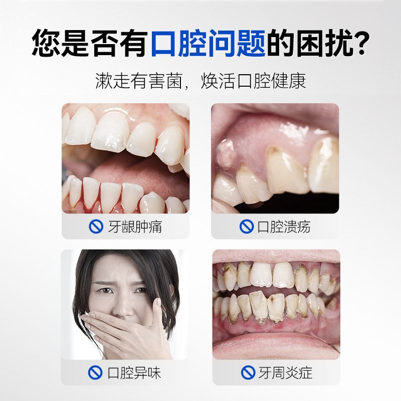 医用漱口水条装便携牙周炎症杀菌消炎除异味持久留香缓解口腔溃疡,淘宝优惠券,粉丝福利购,淘宝优惠卷