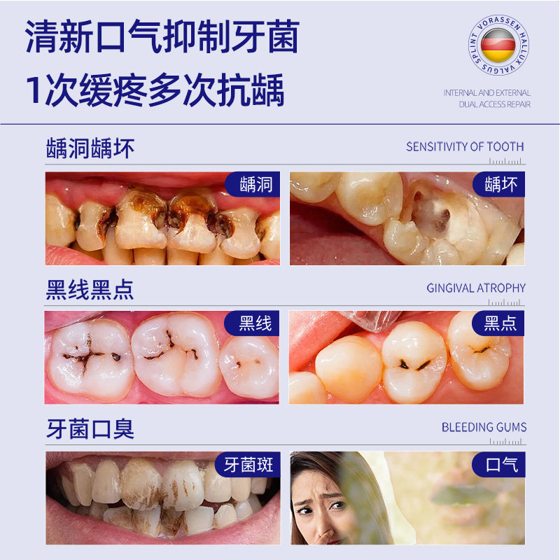 沃朗森非牙膏含氟成人防蛀牙龋齿修复专用去黄口臭抗敏感医用正品-图0