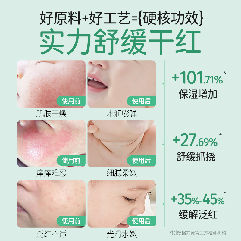 松达婴儿山茶油面霜宝宝护肤山茶油新生儿面霜护臀油【加倍护肤】