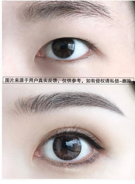 蕾丝双眼皮贴多层眼皮调整