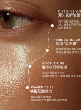 花草轻盈水控油改善闭口