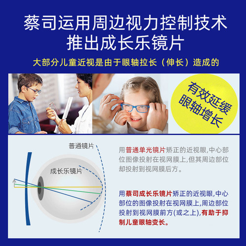 蔡司镜片1.60非球面成长乐莲花膜儿童近视专业控制型眼镜片1片 - 图3