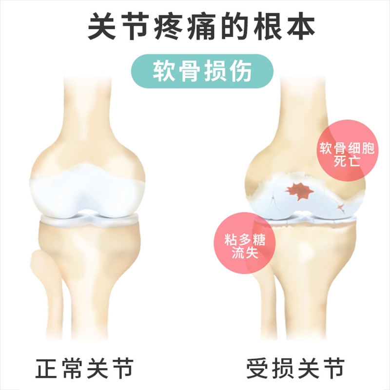 4C软骨素 - 图1