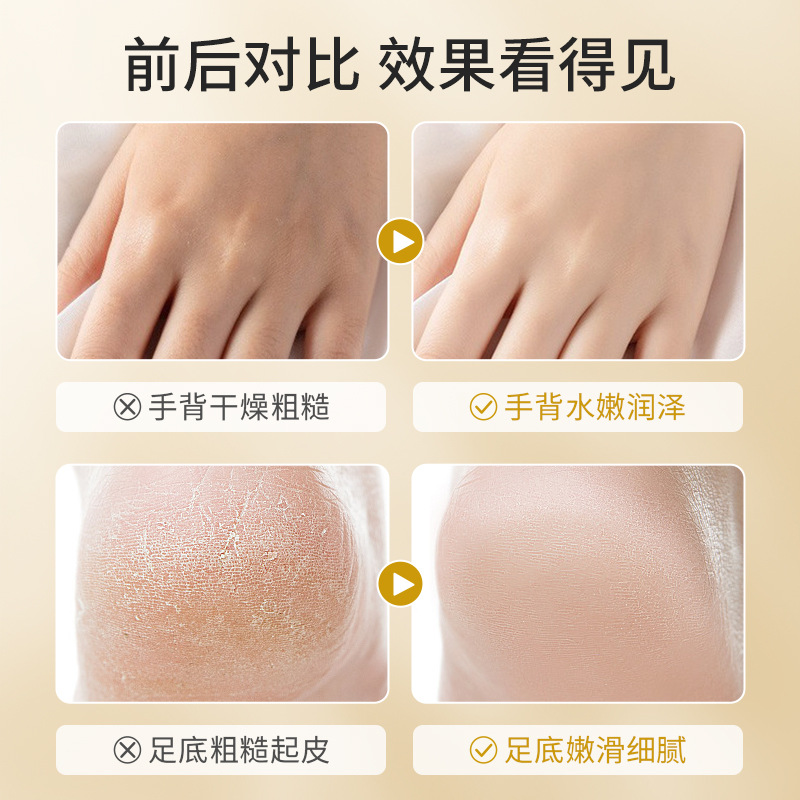 若肤滋润皴裂膏护肤防干裂皲裂软化角质秋冬滋润细滑肌肤保湿霜 - 图2