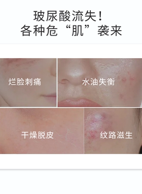 正品ZUZU能量尿酸原液补水保湿