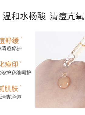 草本精华液暗疮快速清除粉刺