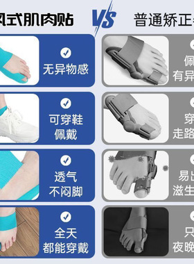 大脚趾外翻拇外翻肌肉贴提升足弓
