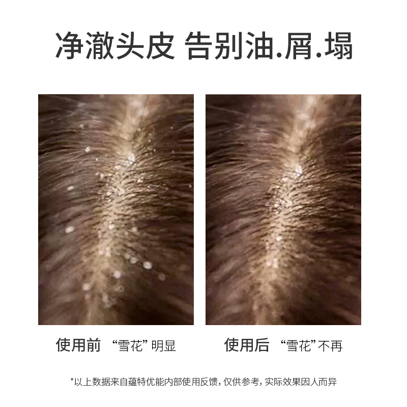 蕴特优能洗发水去屑调护露女净爽蓬松柔顺护理发丝沙龙官方旗舰店
