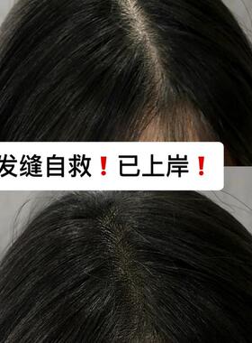 网红爆款发际线粉填充神器阴影修容补发髻发缝遮盖泥阴影粉耐汗女