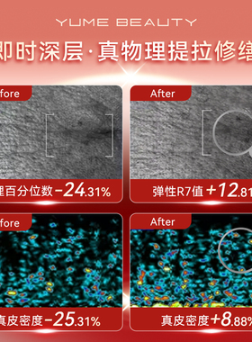 【物理提拉】紧致轮廓高贴合发带