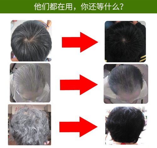 美飘扬一梳黑人参五贝子纯植物提取染发剂汉方清水自然黑发防过敏 - 图2