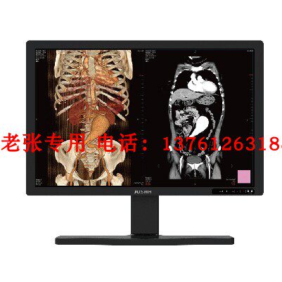 JUSHA巨鲨3M 5MP医疗用显示器临床诊断PACS EIZO艺卓仙艺KTC康冠_虎窝淘