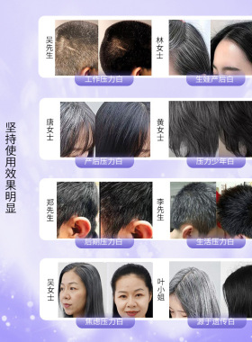德国专研白发按摩梳EMS光波能量震动养黑固生发健发梳激光育发