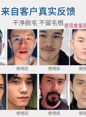 【男士专用面部温和脱毛膏】