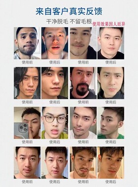 【男士无痛无黑点胡子脱毛膏】