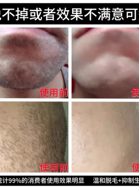 男士脱毛膏胡子胡须去腋下脸部腿毛私密处络腮胡体毛茬根面部专用