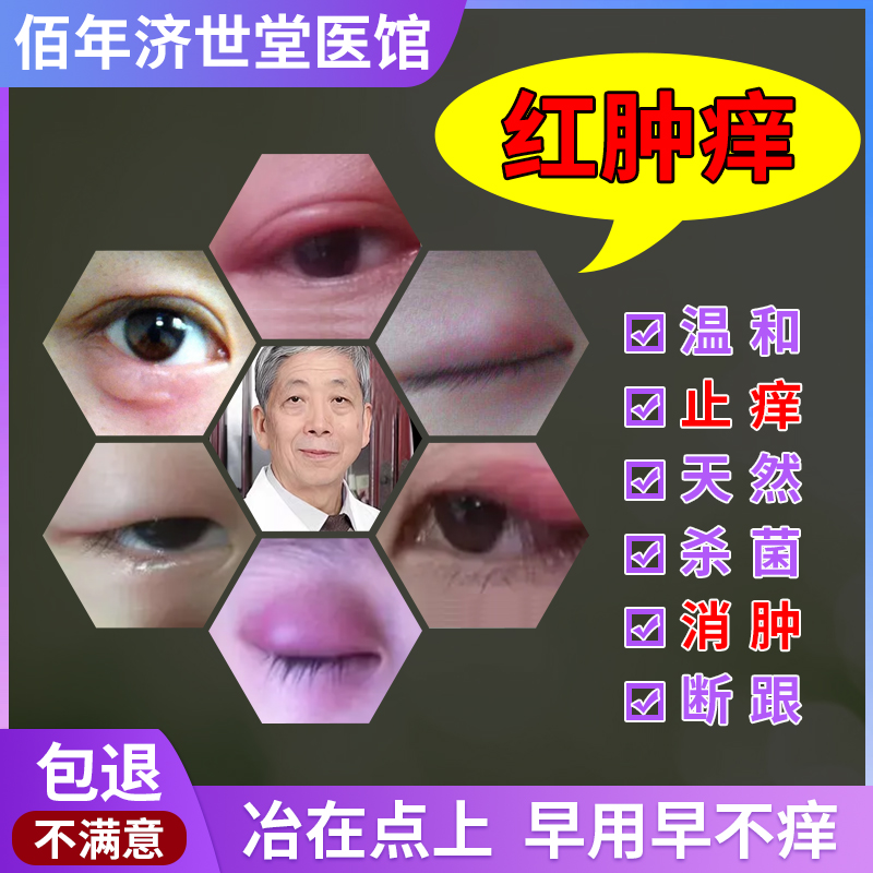 眼皮癣眼睛周围眼角痒干燥起皮掉屑眼周过敏红肿保湿止痒特效眼膏 - 图0